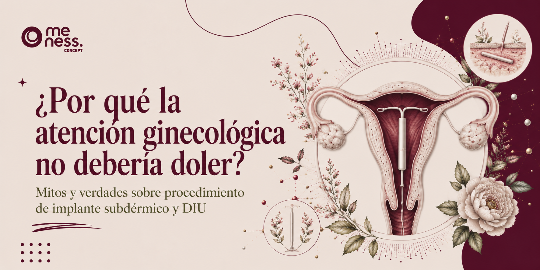 ¿Por qué la atención ginecológica no debería doler? Mitos y verdades sobre procedimiento de implante subdérmico y DIU